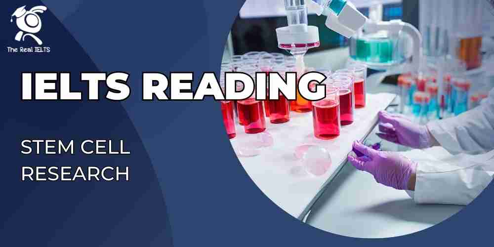 ielts-reading-16-stem-cell-research